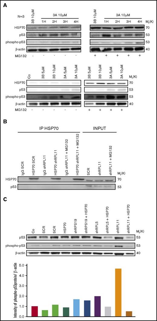 Figure 7. HSP70 and p53 expression level analysis. (A) Study of HSP70, p53, phosphorylated (Ser15) p53 protein expression level compared with actin in normal erythroid cells from CD34+ primary cells at day 7 of the erythroid culture. Cells have been treated with nutlin 3A, a p53 activator, which increased p53 stabilization, for 1 hour (1H) to 4 hours (4H) compared with nutlin 3B, the inactive enantiomer. In addition, these erythroid cells have been treated with (right western blot) or not (left western blot) MG132 proteasome inhibitor at 10 µM for 1 hour. Different concentrations of nutlin 3A and 3B (5 to 10 µM) for 1 hour have been also tested with (right western blot) or not (left western blot) MG132 proteasome inhibitor at 10 µM for 1 hour (western blots below). (B) Immunoprecipitation of HSP70 revealed by an antibody against p53 and HSP70 as a control in depleted RPL11 (shRPL11) UT7-EPO dependent erythroid cells, compared with the control (shSCR) after or not a MG132 treatment. IgG SCR lane: IgG control antibody in shSCR infected cells; HSP70 SCR: immunoprecipitation with a specific antibody for HSP70 in shSCR infected cells; IgG shRPL11: IgG control antibody in RPL11 depleted cells; HSP70 shRPL11: immunoprecipitation with a specific antibody for HSP70 in RPL11 depleted cells; IgG shRPL11+MG132: IgG control antibody on shRPL11 depleted erythroid cells after treatment with MG132; HSP70 shRPL11+MG132: immunoprecipitation with a specific antibody for HSP70 in RPL11 depleted cells, treated with MG132. The expression level analysis of HSP70 and p53 has been performed in total cell lysate (INPUT lanes) in order to validate that the p53 and HSP70 were correctly expressed in the samples before immunoprecipitation. (C) Study of p53, phosphorylated (Ser15) p53 protein expression compare with actin in depleted RPS19, RPL5, or RPL11 erythroid cells from CD34+ primary cells at day 7 of erythroid culture after a rescue or not with the lentivirus containing the WT HSP70 cDNA. Quantification of P-p53 compared with β-actin (bottom panel) has been performed on Image J, Java Image processing program (NIH Image).