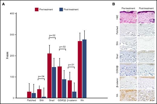 Figure 1. Immunohistochemical evaluation of hedgehog signaling pathway molecules. (A) Mean H-scores for hedgehog signaling pathway molecules obtained from pre- and posttreatment skin biopsies from 13 evaluable patients. The H-score is calculated by multiplying the percentage of cells staining for a given molecule in a fixed field by the staining intensity (0 = none, 1 = weak, 2 = moderate, 3 = intense), with final scores ranging from 0 to 300. (B) Histochemical staining demonstrating a decrease in staining intensity for hedgehog pathway molecules in skin biopsies from a sample clinical responder. Hematoxylin and eosin (H&E) stain, original magnification ×600; all other stains, original magnification ×200. GSK3β, glycogen synthase kinase 3 β; Ihh, Indian hedgehog; Shh, sonic hedgehog.