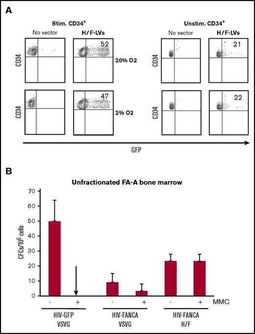 Figure 7. Efficient correction of hematopoietic progenitors in total BM from FA-A patients with H/F-LVs encoding for FANCA. (A) Cytokine prestimulated hCD34+ cells were transduced with GFP encoding H/F-LVs at an MOI of 5 in 20% or 2% oxygen culture conditions. Three days after transduction, the percentage of GFP+ cells was determined by FACS. Data are representative of 3 independent experiments. (B) Cells from an unfractionated FA-A bone marrow sample (n = 3) were prestimulated for 18 hours and transduced with the GFP- or FANCA-encoding LVs as indicated in the presence of retronectin at an MOI of 5 and in low oxygen conditions (5%). CFC assays were performed 24 hours later in the absence or presence of mytomycin C (MMC).