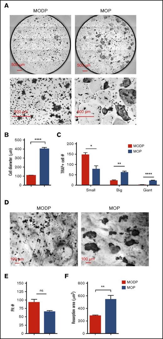 Figure 2. Phenotype and functionality of MODP- and MOP-derived OCs. Sorted MODPs and MOPs were plated at 3000 cells/well with or without bovine bone chips and cultured in the presence of RANKL and M-CSF for 6 days. (A) CCD microscopic images (bottom row: digital zoom in) of TRAP- and DAPI-stained OC cultures. (B-C) Quantitative analysis of MODP- and MOP-derived OCs. Fused cells with multiple nuclei were counted as 1 cell. (B) OC diameter presented as the mean value of 80 (MODP derived) or 100 (MOP derived) TRAP+ OCs. (C) Total TRAP+ OC yield per well in absolute number (#), with OCs subdivided according to nuclei count. Small: 3-10 nuclei; big: 10-20 nuclei; giant: >20 nuclei. Data represent pooled data from 2 experiments (n = 4). Error bars indicate standard error of the mean. (D) CCD microscopic images of CBB-stained OCs on bovine bone chips. (E-F) Quantification by ImageJ capture and manual counting of CBB-stained pits on bone chips from MODP- derived OC cultures (n = 6) and MOP-derived OC cultures (n = 5). In each graph, all pits were counted and measured. Resorption area was calculated as total pit size divided by the number of pits.29 Error bars indicate standard error of the mean. *P < .05; **P < .01; ****P < .0001. ns, not significant.
