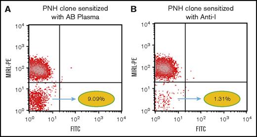 Figure 2. Antibody-mediated lysis of PNH clone. The graphs represent MIRL-positive cells on the y-axis in a PE channel. The x-axis represents a blank fluorescein isothiocyanate channel. A group O RBC sample with a clone of patient PNH RBCs was used for the study. (A) Negative control: RBCs sensitized with pooled AB plasma. (B) An 86% reduction in the size of PNH clone was observed upon sensitization of RBCs with anti-I because of the lysis of PNH clone.