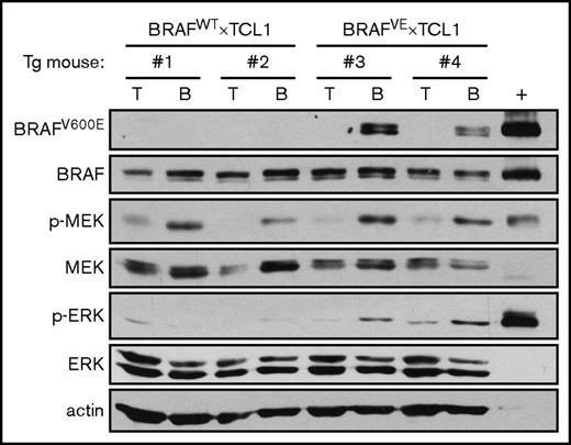 Figure 1. BRAFV600E protein is expressed in the B cells of BRAFVE×TCL1 mice. Lysates from purified B or T cells from spleens of BRAFWT×TCL1 or BRAFVE×TCL1 transgenic (Tg) mice were analyzed by immunoblot for mutant and normal BRAF as well as total and phosphorylated MEK and ERK. Lysate from OSUCLL-BRAFV600E+doxycycline was included as a positive control (+).
