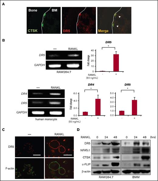 Figure 1. Mature OCs express proapoptotic DRs. (A) CTSK and DR5 were immunostained in green and red, respectively, in a bone section. For staining OCs in bone, the tibiae of ICR-nu/nu mice (CLEA) were taken out, fixed for 2 days in 10% paraformaldehyde/PBS, and decalcified in 10% EDTA (pH 7.4) for 1 week. The tibiae specimens were embedded in paraffin, and then 5 μm thick serial sections were prepared. The deparaffinized sections were blocked with PBS containing 4.0% bovine serum albumin (PBS-BSA) for 1 hour at room temperature. To detect the localization of DR5 and CTSK in the tibia, the sections were incubated with anti-DR5 and anti-CTSK antibodies diluted 1:100 in PBS-BSA overnight at 4°C. After being washed 3 times with PBS, sections were reacted with Alexa Fluor 594–conjugated anti-rabbit IgG and Alexa Fluor 488–conjugated anti-mouse IgG secondary antibodies. The sections were observed under a fluorescence microscope (BX50, Olympus). Original magnification ×100. BM, bone marrow. (B) Murine RAW264.7 preosteoclastic cells were treated with sRANKL (50 ng/mL) for 72 hours, and DR5 mRNA expression was analyzed by RT-PCR (upper). Human monocytes from a healthy donor were treated with M-CSF (10 ng/mL) and sRANKL (50 ng/mL) for 5 days, and DR4 and DR5 mRNA expression was analyzed by RT-PCR (lower). GAPDH was used as an internal control. DR4 and DR5 mRNA expression was also determined using real-time PCR. GAPDH was used as an endogenous control to normalize each sample. Data were expressed as mean ± standard error. *P < .05. (C) Mature OCs derived from RAW264.7 cells were fixed and stained with anti-DR5 antibody (red, upper panels). F-actin and nuclei were stained with phalloidin (green) and Hoechst 33342 (Hoechst, red), respectively (lower panels). Samples were visualized with a fluorescence microscope (BX50, Olympus). Original magnification ×100. Bar represents 100 μm. (D) RAW264.7 cells (left) or mouse BMMs (right) were treated with sRANKL (50 ng/mL) for the indicated time periods, and then cell lysates were collected. The expression of DR5, c-FLIP, NFATc1, and CTSK was analyzed by western blotting. β-actin served as a loading control.