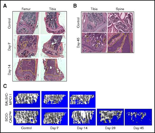 Figure 2. Establishment of a mouse myeloma model with skeletal dissemination of tumor and osteolysis. Two different mouse models were tested for myeloma osteolytic dissemination. Groups of BALB/c mice were challenged with 5 × 105 MPC-11 cells, and SCID mice were challenged with 5 × 105 CAGHep cells via tail vein. Based on constitutive expression of firefly luciferase in both cell lines, mice were monitored by noninvasive imaging to monitor tumor growth within the tibia, femur, and spine. Cohorts of mice from each group were euthanized at the indicated time points, and bones were subjected to histology (A-B; original magnification ×100, hematoxylin and eosin stain) and micro-CT (C). Representative data indicate aggressive tumor growth and skeletal damage in the BALB/c-MPC-11 model by 2 weeks. However, the growth of myeloma cells in the SCID-CAGHep model was significantly delayed, allowing a window of >6 weeks before aggressive bone destruction was noted.