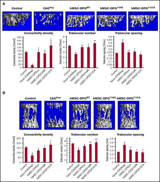 Figure 4. Micro-CT and quantitative analysis of tibia and spine following hMSC-OPG therapy. Four weeks after tumor challenge, a time established as midpoint for the degree of osteolytic damage, cohorts of mice from untreated and indicated treatment groups were euthanized, and tibia (A) and spine (B) were subjected to micro-CT analysis. Data obtained from micro-CT were used in 3D reconstruction images and quantitative analysis of respective bones for connectivity density, trabecular number, and trabecular spacing (*P < .05; **P < .01, compared with untreated mice following tumor challenge).