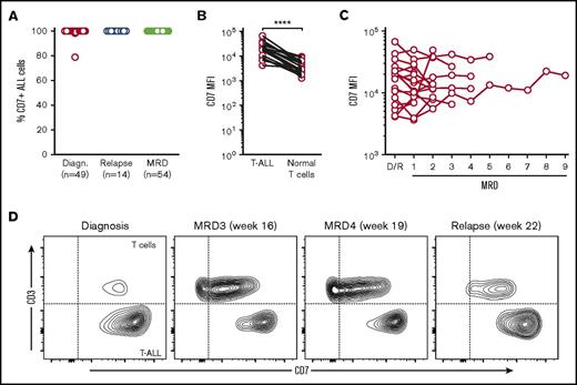 Figure 1. CD7 expression in T-ALL. (A) The percentage of ALL cells expressing CD7 at diagnosis, relapse, and during chemotherapy (MRD); the number of bone marrow samples studied at each stage is shown. (B) CD7 mean fluorescence intensity (MFI) in T-ALL cells and residual normal T cells from the same samples (n = 19; ****P < .0001 by paired Student t test). (C) CD7 MFI in T-ALL cells at diagnosis or relapse (D/R) and in follow-up bone marrow samples with MRD (n = 18). (D) Flow cytometric contour plots illustrate CD7 expression in T-ALL cells (CD3 negative) and normal T cells (CD3 positive) at diagnosis, MRD, and relapse in 1 representative patient.