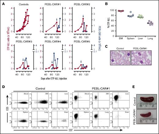 Figure 7. PEBL-CAR T-cell activity against ETP-ALL in a patient-derived xenograft (PDX) model. (A) Primary ETP-ALL cells, previously propagated in NOD-SCID-IL2RGnull mice, were infused IV in 10 NOD-SCID-IL2RGnull mice at 2 × 106 cells per mouse. Five mice (Control) were left untreated. The remaining 5 mice received a single IV infusion of PEBL-CAR T cells (2 × 107 in PEBL-CAR#1 mouse, 2 × 106 in the remaining 4 mice) at the indicated time point (blue arrow), as well as 20 000 IU IL-2 IP every 2 days; IL-2 was also administered to 2 of the 5 control mice. Red symbols (left y-axes) indicate the number of ETP-ALL cells per milliliter counted in peripheral blood. Blue symbols (right y-axes) show the numbers of PEBL-CAR T cells. The mice were euthanized when the percentage of ETP-ALL cells among blood mononucleated cells reached ≥80%. (B) The percentage of ETP-ALL (denominator, total human plus mouse CD45+ cells) in various organs of the 5 untreated mice. (C) Blood smears of treated (PEBL-CAR#1) and untreated ETP-ALL 7 days after infusion of T cells; smudge cells were prominent in blood after infusion of PEBL-CAR T cells. Original magnification ×40, Wright stain. (D) Flow cytometric dot plots show the presence of CD7+ CD3– ETP-ALL cells in the tissues of an untreated control mouse with ETP-ALL and of CD7– CD3+ PEBL-CAR T cells in the PEBL-CAR#1 mouse treated with PEBL-CAR T cells. No ETP-ALL (<0.01%) was detected in the treated mouse. The events shown were normalized to the events acquired for the corresponding plots shown in the control mouse. (E) Spleens of treated (PEBL-CAR#1) and untreated mice. BM, bone marrow.