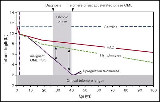 Figure 5. Telomere length in CML. The difference in telomere length between CML blast cells relative to T lymphocytes in the same patient correlates with disease progression. See also Figure 3. Most likely cells with defective DNA damage responses are selected when telomeres get critically short, allowing for rapid selection of more malignant, chromosomally unstable cells with additional genetic abnormalities, such as mutations in TERT promoter, amplification of the TERT gene, etc. Figure adapted from Brümmendorf et al.31