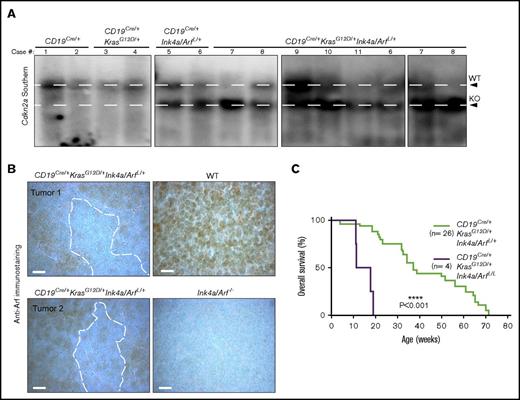 Figure 5. Loss of heterozygosity of the Ink4a/Arf (Cdkn2a) locus in pre-B-ALL. (A) Southern blot analysis of the Ink4a/Arf locus. WT, wild-type fragment of the Ink4a/Arf locus; KO, knockout configuration of the Ink4a/Arf locus. Loss of the upper WT band is indicative of loss of heterozygosity (LOH) of the Ink4a/Arf locus (see supplemental Figure 6). (B) Anti-Arf immunostains in the LNs of mice of the indicated genotypes. The specificity of Anti-Arf antibody was confirmed in LNs from Ink4a/Arf−/− mice. Scale bar, 10 µm. (C) Kaplan-Meier survival plot illustrating the impact of homozygous Ink4a/Arf deletion on survival of mice with KrasG12D mutation in the B-cell compartment. P values were calculated by using the log-rank test.