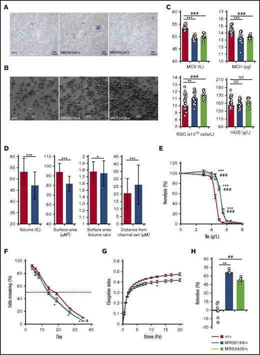 Figure 1. Hematological properties of mutant lines MRI26194 and MRI53426. Representative Giemsa-stained smears (A) and standard error of the mean (SEM) images (B) of erythrocytes from wild-type (WT; +/+) and both mutant lines. Hematological properties from an automated blood count. (C) Mean cell volume (MCV), mean cell hemoglobin (MCH), RBC (erythrocyte) count, and hemoglobin (HGB) by volume (n = 14-36 per group). (D) Mean values for volume, surface area, ratio of surface area to volume, and distance from channel exit of cell populations for WT (3 mice, 642 cells) and MRI2694 (2 mice, 233 cells) erythrocytes. (E) Osmotic fragility of erythrocytes (n = 8-35 per group). (F) Erythrocyte lifespan (n = 4 per group); dashed line is 50%. (G) Erythrocyte deformability as measured by ektacytometry (n = 3-6 per group). (H) Retention of erythrocytes in an in vitro spleen bead filtration model (n = 7 per group). Mean and SEM are indicated, except for microfluidic results, where standard deviation is indicated. Mann-Whitney U test was used to calculate P values. *P < .05, **P < .01, ***P < .001 between MRI26194 and WT. #P < .05, ##P < .01, ###P < .001 between MRI53426 and WT. NS, not significant.