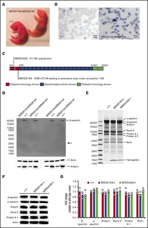 Figure 2. The MRI26194 and MRI53426 phenotypes are due to mutations in Sptb. (A) Mating between SptbMRI26194/+ by SptbMRI26194/+ mice occasionally produced homozygous pups displaying jaundice. (B) Giemsa-stained blood smears from WT and homozygous pups. (C) Schematic of the β spectrin protein indicating different structural domains, and the locations and predicted effects of the mutations identified in the MRI26194 and MRI53426 lines. (D) Western blot of whole RBC lysates from homozygous and WT pups separated by sodium dodecyl sulfate–polyacrylamide gel electrophoresis (SDS-PAGE) on a 4% to 20% gel and probed using an antibody against the N-terminal of β spectrin, with actin and ankyrin-1 as loading controls. The expected size of the truncated β spectrin (24 kD) is indicated with an arrow. (E) Representative image of a Coomasie-stained SDS-PAGE gel containing erythrocyte membrane preparations from mutant and WT mice. (F) Images of western blots of major skeletal proteins in erythrocyte membrane preparations from mutant and WT mice. (G) Quantification of protein bands detected by western blot (3 mice per group).