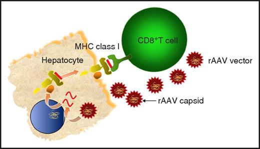 Figure 1. Hypothesis of the cellular immune response to hepatocytes after rAAV transduction. rAAV enters the hepatocyte by receptor-mediated endocytosis, wherein the vector genome, including the transgene, is released from the capsid (uncoating). Thereafter, the capsid is degraded in the cytosol, and capsid peptides are loaded onto major histocompatibility complex (MHC) class I on the surface of the transduced hepatocytes. Presentation of capsid peptides on MHC class I triggers a cellular immune response to the transduced hepatocytes, resulting in clearance of the hepatocyte.