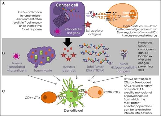 Figure 1. Antigen-specific T-cell strategies for lymphomas. (A) In vivo, intracellular antigens are presented on MHC-I molecules, where CTLs can engage directly with the MHC-I–peptide complex on the surface of the cancer cell. Surface antigens can be targeted indirectly via presentation by antigen-presenting cells or directly by antibodies. This process is often ineffective in cancer patients. (B) Antigen presentation is enhanced in T-cell–mediated therapies, as tumor-derived material is presented by appropriately activated antigen-presenting cells, most commonly DCs. Antigenic DC loading of tumor-associated viral peptides, lysed tumor cells, known antigenic tumor peptides, total tumor RNA (TTRNA), and minor histocompatibility proteins have all been attempted in hematological T-cell–based immunotherapy. (C) T-cell–based therapies enhance the T-cell response by ensuring appropriate costimulation and optimal environmental conditions for T-cell activation. This process allows TAA-specific T-cell clones, or polyclonal multiantigen-specific T cells, to be expanded ex vivo from patients or healthy donors for infusion into patients.