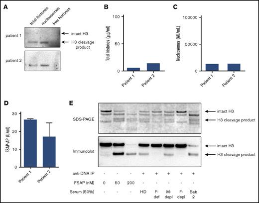 Figure 6. Free histones are not detectable in the sera of patients with meningococcal sepsis. (A) The presence of nucleosomes and free histones was analyzed in serum of 2 patients with meningococcal sepsis. As before, total histones, nucleosomes, or free histones were immunoprecipitated and separated on gel, and histone H3 was visualized (A) and quantified (B) using a histone titration on the same blot. (B) Histone levels as determined via densitometric analysis. (C) Nucleosome levels as determined in the sera by ELISA (D). FSAP-AP levels were determined by ELISA to verify FSAP activation. Blots of the patient samples are representative of 2 independent experiments because of limited sample availability. (E) Purified nucleosomes were incubated with plasma-purified FSAP (0, 50, or 200 nM), healthy donor serum (HD), FSAP-deficient serum (F-def), mock-depleted serum (M-depl), or FSAP-depleted serum (F-depl; 50%) and were immunoprecipitated from serum using an anti-DNA antibody coupled to sepharose. The cleavage products and the nucleosomes previously immunoprecipitated from a septic baboon serum (Figure 5D baboon 2, lane 2) were separated by SDS-PAGE, and histones were visualized by instant blue staining (upper panel), or histone H3 and its cleavage product were visualized by an anti–histone H3 antibody on immunoblot (lower panel). Arrows indicate intact histone H3 or a cleavage product of histone H3.