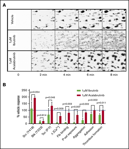 Ibrutinib, but not acalabrutinib, causes thrombus instability. Whole blood from healthy donors was incubated with vehicle, 1 µM ibrutinib, and 1 µM acalabrutinib for 20 minutes and flowed through collagen-coated microfluidic flow chambers at a shear rate of 1000 s−1 for 6 minutes. (A) Representative images of thrombi formed under each of the conditions tested at 2-minute intervals. (B) A summary of effects of 1 µM ibrutinib and 1 µM acalabrutinib on thrombus formation on collagen and other platelet signaling and functional measurements relative to vehicle-treated control. Bars represent the mean ± SD; P values were calculated using multiple tests with Holm-Sidak correction for multiple comparisons.