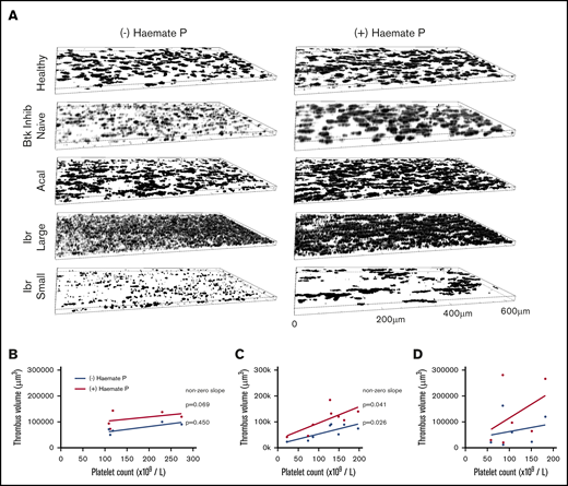 Thrombus formation on collagen correlates with platelet count during treatment with acalabrutinib but not with ibrutinib. (A) Blood from healthy donors (n = 6), Btk-inhibitor naïve CLL patients (n = 5), patients receiving ibrutinib (n = 6) or acalabrutinib (n = 8) was perfused through collagen-coated microfluidic flow chambers at room temperature at a shear rate of 1000 s−1 before being fixed with 10% formyl saline. Fixed samples were stained with DioC6 and z-stack images acquired to enable estimation of thrombus volume. (A) Representative images of thrombi in blood from a healthy donor and patients in the presence or absence of Haemate P (intermediate factor VIII) added ex vivo. Thrombus volume plotted against platelet count for (B) Btk inhibitor naïve CLL patients; patients treated with (C) acalabrutinib or (D) ibrutinib with or without added Haemate P. Correlation between platelet count and thrombus volume is significant in the presence or absence of Haemate P for acalabrutinib patients (significantly nonzero, P ≤ .05) but nonsignificant for ibrutinib patients (P > .05).