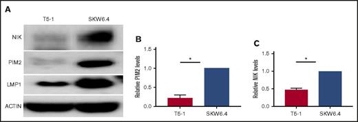 Figure 3. Impact of LMP1 expression on levels of proviability kinases in human BCL cell lines. (A) Representative experiments in which whole-cell lysates of the indicated cell lines were subjected to SDS-PAGE and western blotted for NIK, PIM2, LMP1, and actin as described in “Methods.” (B) Relative PIM2 protein levels (presented as mean ± SE from 3 independent experiments as in A), with PIM2 levels in SKW6.4 cells set as 1. (C) Relative NIK protein levels (presented as mean values ± SE from 3 independent experiments as in A), with NIK levels in SKW6.4 cells set as 1. Statistical significance of differences was calculated as described in “Methods”; *P < .006.