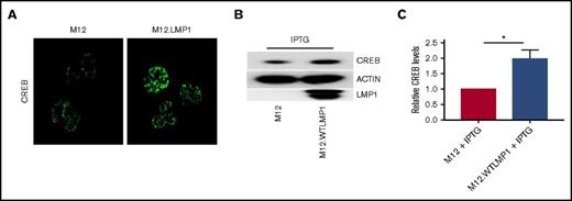 Figure 7. Relationship between LMP1 expression and levels of nuclear CREB in BCL cells. (A) Parent and LMP1-expressing clones of the M12.4.1 BCL cell line were stained with fluorescent anti-CREB antibody and analyzed by immunofluorescent confocal microscopy as described in “Methods.” Representative images from 6 fields per slide are shown and are also representative of 3 independent experiments with similar results. (B) Whole-cell lysates from the indicated cells were subjected to SDS-PAGE and western blot analysis of the indicated proteins; a representative blot of 3 similar experiments is shown. (C) Relative CREB protein levels (mean ± SE from 3 independent experiments as in panel B) were quantified, with levels in parent M12.4.1 cells set as 1. *P = .01 (Student t test; see “Methods”).