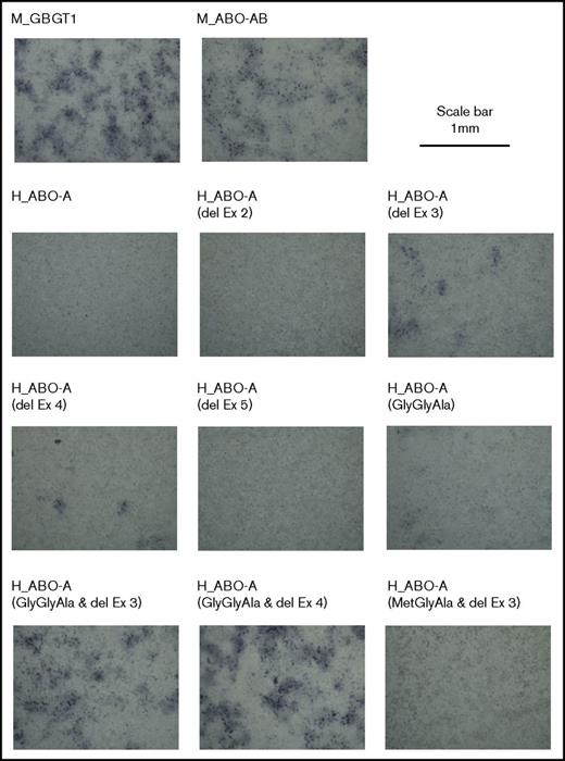 Figure 2. Representative images of cells that were DNA transfected and immunostained. After fixation, cells were incubated with the anti-FORS1 monoclonal antibody and then with a biotinylated secondary antibody. After washing, they were treated with Vectastain ABC reagents. 3,3′-Diaminobenzidine was then used for peroxidase-mediated color development. Photos were taken of cells transfected with different expression constructs, as indicated at the top of the photos. The scale bar of 1 mm is indicated at the top right. del, deletion; Ex, exon.