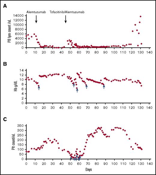 Figure 2. Trends of peripheral counts through treatment. Absolute lymphocyte count (A), hemoglobin (B), and platelet count (C) in the peripheral blood before and after treatment are shown in the y-axis; x-axis represents timeline in days. The time points at which alemtuzumab and tofacitinib were added are indicated by arrows. The time points at which the patient received red blood cell transfusions for panel B and platelet transfusions for panel C are indicated by blue arrows. Hb, hemoglobin; PB, peripheral blood; Plt, platelet.