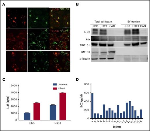 Figure 2. IL-32 is secreted from myeloma cells on EVs. (A) JJN3 cells were stained for IL-32 (red), GM130 (Golgi marker; green), CD63 (EV marker; green), and CD81 (EV marker; green). Scale bar, 15 μm. (B) Total cell lysates and lysates of EVs isolated from cell culture supernatants were immunoblotted as indicated. (C) EVs were isolated from media from JJN3 cells cultured for 48 hours. IL-32 in the EV fraction treated with or without NP-40 detergent was quantified by ELISA. (D) EVs were isolated from BM plasma obtained from patients with myeloma (n = 18), and amount of IL-32 in the EV fraction was determined by ELISA.