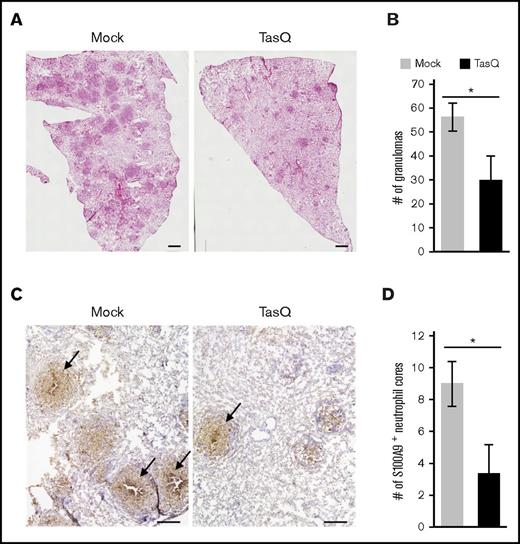 Figure 4. The effect of tasquinimod on granuloma formation. The effect of tasquinimod (TasQ) on granuloma formation was evaluated using the guinea pig granuloma model. (A) Lung sections derived from TasQ-treated (right panel) and mock-treated (left panel) guinea pigs were stained with hematoxylin and eosin, and representative micrographs obtained from 2 independent experiments are shown. Scale bars, 1 mm. (B) Granulomas with a diameter of >200 μm were counted for 3 animals in each group. Numbers of granulomas per section are shown as the mean ± standard error of the mean. *P < .01. (C) Lung sections derived from TasQ-treated and mock-treated guinea pigs were labeled with G213 mAb, and HRP-DAB-based detection was performed. Representative micrographs obtained from 2 independent experiments are presented with granulomas containing the central accumulation of S100A9+ neutrophils indicated with arrows. Scale bars, 500 μm. (D) Granulomas with S100A9+ neutrophil cores were counted per section for 3 animals in each group, and data are shown as the mean ± standard error of the mean. *P < .01.