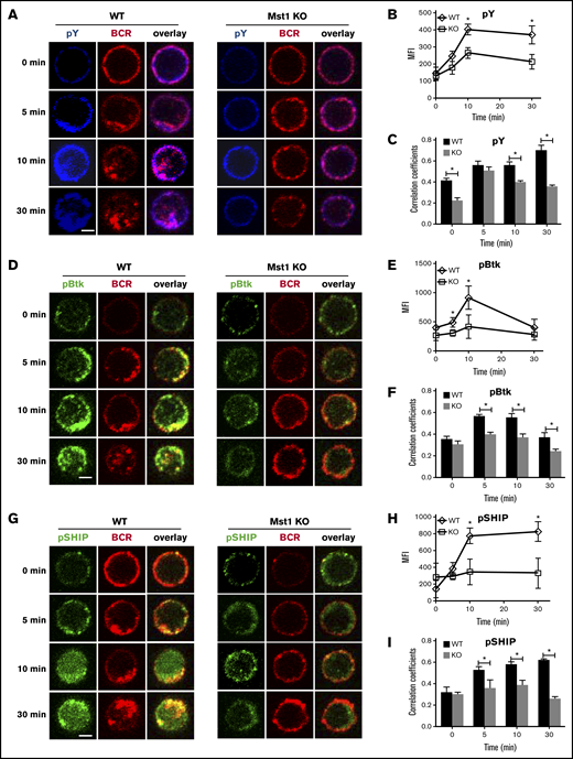 The recruitment of pY, pBtk, and pSHIP to BCR clusters in B cells stimulated by sAg is reduced in Mst1 KO B cells. Splenic B cells were incubated with AF546–mB-Fab′–anti-Ig without (−) or with sAg at 4°C, washed, and warmed to 37°C for varying lengths of time. After fixation and permeabilization, the cells were stained for pY, pBtk, and pSHIP and analyzed using CFm (A,D,G). The MIF of pY, pBtk, and pSHIP was generated using NIS-Elements AR 3.2 software (B,E,H). The Pearson’s correlation coefficients between BCR and pY, pBtk, or pSHIP staining in sAg-stimulated cells were determined using NIS-Elements AR 3.2 software (C,F,I). Shown are representative images at indicated times and the average values (±SD) of ∼50 cells from 3 independent experiments. Scale bars, 2.5 μm. *P < .01.