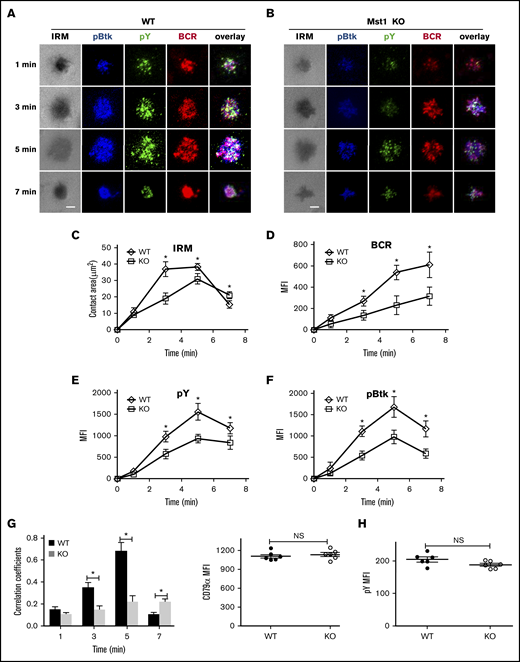 BCR cluster formation, B-cell spreading, and BCR signalsome are reduced in Mst1 KO B cells. Splenic B cells from WT and Mst1 KO mice were incubated with AF546–mB-Fab′–anti-Ig tethered to lipid bilayers at 37°C for indicated times. Cells were fixed, permeabilized, and stained for pY and pBtk using a specific monoclonal antibody and an AF405-conjugated and AF488-conjugated secondary antibody. Cells were analyzed using TIRFm. Shown are representative images (A-B) and the average values (± SD) of the B-cell contact area (C), the MFI of the BCR (D), and the MFI of the pY (E) and pBtk (F) in the contact zone. TIRFm analysis of the spatial relationship of BCR with pY and pBtk in the contact zone of splenic B cells incubated with membrane-tethered Fab′–anti-Ig. The colocalization coefficients between BCR and pY and pBtk staining were determined using NIS-Elements AR 3.2 software (G). Flow cytometry analysis of the MFI of pY (H) in WT and Mst1 KO B cells without antigen stimulation. The data were generated using 20 to 90 cells from 3 independent experiments. Scale bars, 2.5 μm. *P < .01. NS, not significant.