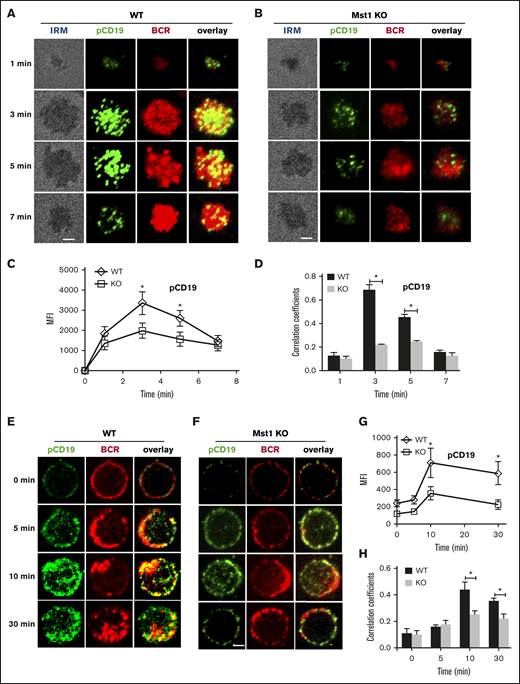 pCD19 recruitment to BCR aggregation is reduced in Mst1 KO B cells after stimulation. Splenic B cells from WT and Mst1 KO mice were incubated with AF546–mB-Fab′–anti-Ig tethered to lipid bilayers at 37°C for indicated times. Cells were fixed, permeabilized, and stained for pCD19 using a specific monoclonal antibody and AF488-conjugated secondary antibody. Cells were analyzed using TIRFm (A-B). The MFI of pCD19 staining in the B-cell contact zone was quantified (C). Shown are representative images and TIRFm analysis of the spatial relationship of BCR with pCD19 in the contact zone of splenic B cells incubated with membrane-tethered Fab′–anti-Ig. The correlation coefficients between BCR and pCD19 staining were determined using NIS-Elements AR 3.2 software (D). Splenic B cells were incubated with AF546–mB-Fab′–anti-Ig without (0 minutes) or with sAg at 4°C, washed, and warmed to 37°C for varying lengths of time. After fixation and permeabilization, the cells were stained for pCD19 and analyzed using CFm (E-F). The MIF of pCD19 was generated using NIS-Elements AR 3.2 software (G). The Pearson’s correlation coefficients between BCR and pCD19 staining in sAg-stimulated cells were determined using NIS-Elements AR 3.2 software (H). Shown are representative images at indicated times and the average values (±SD) of ∼50 cells from 3 independent experiments. Scale bars, 2.5 μm. *P < .01.