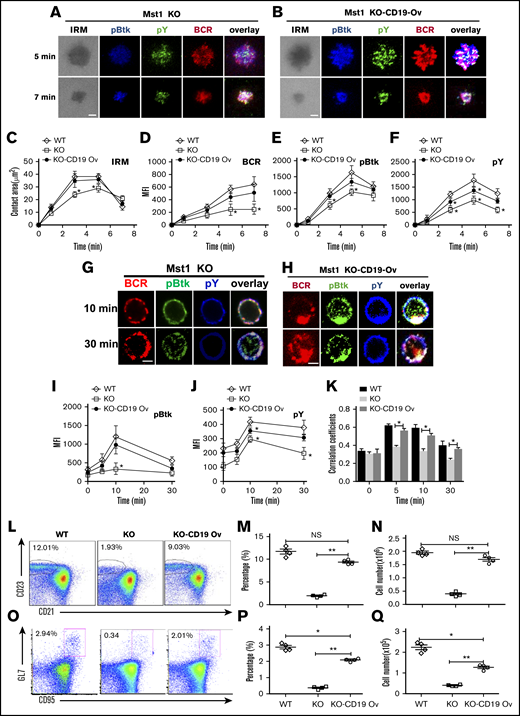 Overexpression of CD19 rescuesthe defect of Mst1 deficiency. WT bone marrow cells were transduced with GFP-tagged retroviral vector only. Mst1 KO bone marrow cells were transduced with GFP-tagged retroviral vector expressing with or without CD19, and then transferred into CD45.1 mice recipients together with CD45.1 WT bone marrow cells. After reconstitution, CD45.2 +GFP+ donor-derived splenic B cells were sorted and incubated with lipid bilayers at 37°C. Cells were fixed, permeabilized, and stained for pY and pBtk and then analyzed using TIRFm. Shown are representative images (A and B) and the average values (± SD) of the B cell contact area (C), the MFI of the BCR (D), and the MFI of the pBtk (E) and pY (F) in the contact zone. Sorted CD45.2 +GFP+ donor-derived splenic B cells were incubated with AF546–mB-Fab′–anti-Ig for 10 minutes at 4°C to label the BCR. Then, the cells were incubated with sAg at 37°C for varying lengths of time. After fixation and permeabilization, the cells were stained for pBtk and pY (G and H). The MFI of pBtk (I) and pY (J) and colocalization coefficients between BCR and pY and pBtk staining were determined using NIS-Elements AR 3.2 software (K). WT or Mst1 KO bone marrow cells were transduced with GFP-tagged retroviral vector expressing with or without CD19 and then transferred into CD45.1 mice recipients, and CD45.2 +GFP+-derived MZ B cells were analyzed by flow cytometry after bone marrow reconstitution (L). The quantification of percentage (M) and number (N) of CD45.2 +GFP+-derived MZ B cells in the spleen of WT and Mst1 KO chimera mice. WT or Mst1 KO bone marrow cells were transduced with GFP-tagged retroviral vector expressing with or without CD19 and then transferred into CD45.1 mice recipients subsequently immunized with OVA; CD45.2 +GFP+-derived GC B cells were analyzed by flow cytometry after bone marrow reconstitution (O). The quantification of percentage and number of CD45.2 +GFP+-derived GC B cells in the spleen of WT and Mst1 KO chimera mice (P-Q). Scale bars, 2.5 μm. *P < .01, **P < .001.