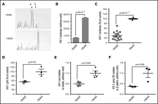 Figure 1. Inhibition of HIV-1 in SCD-derived PBMCs. (A) HPLC analysis of SCD hemoglobin. HPLC of representative blood samples obtained from an SCD subject with HbSS hemoglobin and normal control with HbAA hemoglobin. (B-C) Inhibition of 1 round of HIV-1 infection in SCD-derived PBMCs. PBMCs were purified from whole blood obtained from SCD patients and healthy controls. The cells were activated with PHA and IL-2 and infected with HIV-1-LUC-G virus expressing luciferase. Luciferase activity was measured at 24 hours postinfection (PI) and normalized to the cell numbers. (B) A representative sample that corresponds to panel A. (C) Comparison of 1 round of HIV-1 replication in a cohort of 15 SCD patients. The results are expressed relative to infection of PBMCs from 9 control subjects, which were set to 100%. The means ± standard error (SE) and P value calculated with Student t test are shown. (D) Inhibition of p24 production in SCD-derived PBMCs. PBMCs obtained from 3 SCD patients and 3 controls were activated and infected as described above. Supernatants were collected 72 hours PI, and p24 was measured by ELISA. The means ± SE and P value calculated with Student t test are shown. (E) Inhibition of HIV-1 env expression in SCD-derived PBMCs. PBMCs obtained from 4 SCD patients and 4 controls were activated and infected as described above for 48 hours. RNA was extracted, reverse transcribed, and analyzed with primers for HIV-1 env gene by RT-PCR using 18S RNA as a reference. The means ± SE and P value calculated with Student t test are shown. (F) Inhibition HIV-1 RT in SCD PBMCs. PBMCs obtained from 3 SCD patients and 3 controls were activated with PHA and IL-2 and infected with HIV-1-LUC-G. At 6 hours PI, DNA was extracted and analyzed by RT-PCR on Roche 480 using primers for early LTR and β-globin gene as a reference. The means ± SE are shown (n = 3 for each sample). The means ± SE and P value calculated with Student t test are shown.
