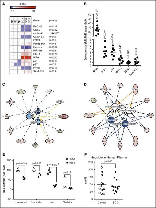 Figure 2. Altered iron metabolism in SCD-derived PBMCs is critical for HIV-1 inhibition. (A) Heat map showing expression of selected iron and HIV-1 regulatory genes in SCD PBMCs. RNA was extracted from PBMCs obtained from 3 SCD patients and 3 controls. RNA was reverse transcribed and analyzed by RT-PCR using primers for BACH1, CDK2, Cyclin A, Cyclin E, EGR1, ferroportin, hepcidin, HIF-1α, HO-1, IKBα, p21, p27, PP1α, and SAMHD1. The 18S RNA was used as a housekeeping control gene. Heat map was constructed using Morpheus software. P values were determined using paired Student t test. (B) Validation of candidate genes expression. Expression of IKBα, HO-1, p21, HIF-1α, and ferroportin mRNA was analyzed from additional 3 controls and 7 SCD PBMCs. SAMHD1 expression was analyzed in 3 controls and 6 SCD PBMCs. RNA was isolated, reverse transcribed, and analyzed by real time. 18S rRNA was used as a reference for ΔΔCt analysis. The means ± SE and P value calculated with Student t test are shown (C) IPA of the iron and HIV-1 regulatory genes. Ingenuity software analysis of genes shown in panel A identified a protein network that connected iron and HIV-1 regulatory genes through virus replication, anemia, and cell cycle progression networks (D). Upregulated genes are colored in red and downregulated genes are colored in green. (D) IPA of viral and pathogen restricting genes in SCD. Ingenuity software analysis of 250 upregulated and downregulated genes determined by meta-analysis of Geoset GSE53441 (data from PBMCs of 24 SCD patients and 10 controls) identified a protein network of 12 genes involved in antiviral response and viral replication. (E) Hepcidin restores HIV-1 replication in SCD PBMCs. Activated PBMCs from 3 SCD patients and 3 control individuals were infected with HIV-1-LUC-G virus and treated with 0.9 μM hepcidin, 20 μM ferric ammonium citrate (iron), or 10 μM PPYeT iron chelator. At 48 hours PI, luciferase activity was measured. The means and P values determined by Student t test are shown. (F) Hepcidin in plasma from SCD patients. Hepcidin was measured in plasma obtained from 13 SCD and 12 healthy subjects by HR/SIM method. The means and P values determined by Student t test are shown.