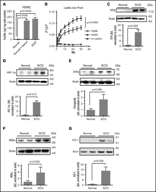 Figure 3. Deregulation of intracellular iron in SCD PBMCs. (A) Increased ferritin expression in SCD PBMCs. PBMCs obtained from 3 SCD patients and 3 controls were cultured in media supplemented with PHA for 36 hours and then activated with IL-2 for 36 hours. Where indicated, control PBMCs were further treated with 100 μM hemin for 24 hours. Ferritin was measured in cell lysates by ELISA. The means ± SD are shown. (B) Reduced intracellular iron levels in SCD PBMCs. Labile intracellular iron pool was measured in PBMCs obtained from 3 SCD patients or 3 normal controls. Cells were treated with 0.1 μM calcein AM for 10 minutes at 37°C. After washing with PBS, cells were incubated at 37°C, and calcein fluorescence was measured in a Glomax Multidetection system at different time points. Fractional fluorescence (F − F0)/F, which is inversely proportional to the amount of chelatable iron plotted on the y-axis. Paired Student t test was used to determine P value of the iron values at 30 minutes. (C-G) Elevated expression of TFR, HIF-1α, ferroportin, IKBα, and HO-1 in SCD PBMCs. Cell lysates from activated PBMCs obtained from SCD patients and normal controls were resolved on 4% to 12% Bis-Tris gel and probed with antibodies against TFR, HIF-1α, ferroportin (FPN), IKBα, and HO-1. The β-actin was used as loading control. Results were quantified using Image Quant Software. Bars represent independent experiments on 4 patients and 4 controls for HIF-1α and IKBα; 6 SCD patients and 6 controls for ferroportin; and 3 SCD patients and 3 controls for HO-1. The blots show 2 representative SCD and control samples. The means ± SD are shown. P values were calculated using Student t test.