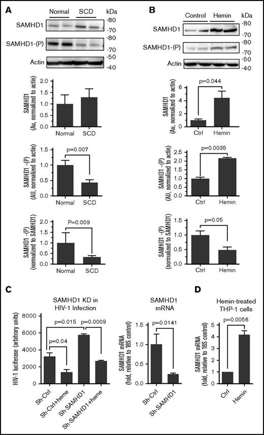 Figure 6. Reduction of SAMHD1 phosphorylation in SCD PBMCs and hemin-treated THP-1 cells. (A) Reduced SAMHD1 Thr-529 phosphorylation in SCD PBMCs. PBMCs obtained from 4 SCD patients and 4 controls were activated with PHA and IL-2 and treated with 75 μM hemin for 24 hours. Cell lysates were resolved on 4% to 12% Bis-Tris gel and probed with antibodies against SAMHD1 and Thr-592 phosphorylated SAMHD1 (SAMHD1-(P)) and β-actin as loading control. Lower panels show quantification for 4 individual samples. Shown are SAMHD1 normalized to β-actin (upper panel), SAMHD1-(P) normalized to β-actin (middle panel), and SAMHD1-(P) normalized to SAMHD1 expression (bottom panel). The means ± SD and P values calculated using Student t test are shown. (B) Increased SAMHD1 expression and reduced Thr-592 phosphorylation in hemin-treated THP-1 cells. THP-1 cells were treated with 75 μM hemin for 24 hours. Cell lysates were analyzed and quantified as in panel A for 4 independent samples. (C) Restoration of hemin-mediated HIV-1 replication by knockdowns of SAMHD1. THP-1 cells were stably transduced with lentiviruses expressing SAMHD1-targeting shRNA and infected with HIV-1-LUC-G virus. Where indicated, the cells were treated with 75 μM hemin. Luciferase activity was measured 2 days PI. The mRNAs were measured by RT-PCR with 18S rRNA as an internal reference for ΔΔCt analysis. The means ± SD and P values calculated using Student t test are shown for 3 independent samples. (D) Hemin treatment increased SAMHD1 mRNA expression. THP-1 cells were treated with hemin for 24 hours. RNA was extracted, reverse transcribed, and analyzed by RT-PCR using primers for SAMHD1 and 18S rRNA as an internal reference for ΔΔCt analysis. The means ± SD and P values calculated using Student t test are shown for 3 independent samples.
