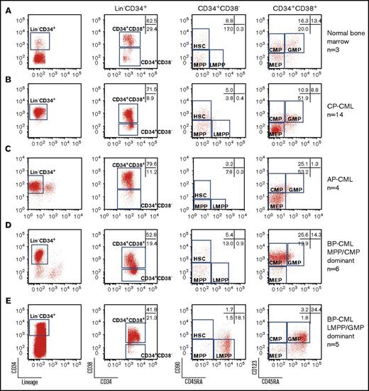 Figure 1. Expansion of LMPP-, GMP-, MPP-, and CMP-like populations in myeloid BP-CML. Representative FACS plots of CD34+ enriched (A) normal bone marrow; (B) CP-CML; (C) AP-CML; myeloid BP-CML with (D) MPP-like and CMP-like populations; or (E) LMPP-like and GMP-like populations. Numbers of samples studied are shown on the right. Markers studied are shown below plots. Numbers in gates are the mean of all samples within the group expressed as a percentage of Lin−CD34+ cells.
