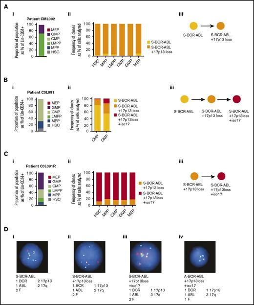 Figure 5. Clonal structures of stem/progenitor populations in myeloid BP-CML. (A-C) Data from patients CML002, COL091, and COL091R. Clone identities denoted by circles or bars. (i) Immunophenotypic HSPC populations in patient sample. y-axis: proportion of population as percentage of Lin−CD34+ cells. (ii) Clonal composition of purified patient populations is based on FISH analysis. x-axis: HSPC population. y-axis: frequency of clones per population. (iii) Clonal hierarchies inferred from FISH data. (D) FISH images: ABL (red); BCR (green); BCR-ABL fusion (F); p53/17p13 (gold); MPO/17q22 (aqua). Atypical BCR-ABL is defined by 1 or 3 BCR-ABL fusions. 17p13 loss is defined by p53 loss. Isochrosome 17q is defined by 3 MPO signals. Numbers of signals detected are indicated.