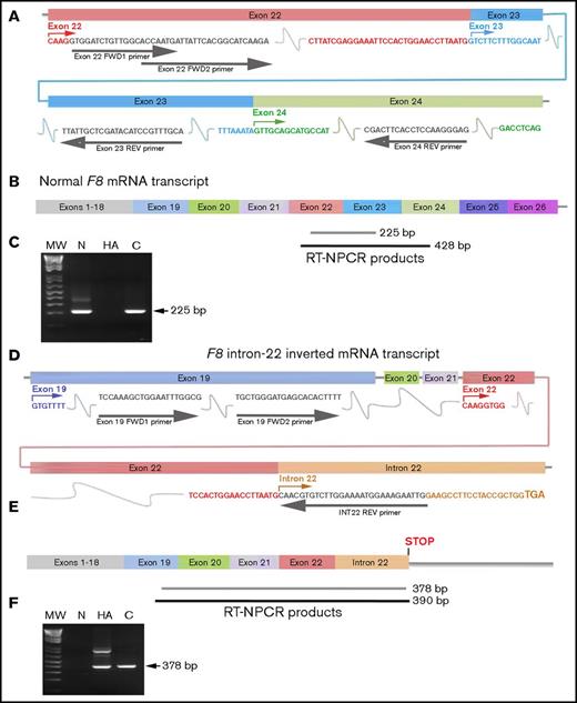 Figure 2. RT-NPCR to detect F8 intron 22 inversion mutations. (A) Schematic representation of exons 22 to 24 in WT F8 mRNA. Primers (gray arrows and font) were designed to hybridize within F8 exons 22 (pink), 23 (turquoise), and 24 (green). (B) WT-F8 mRNA transcript. RT-NPCR produces 428-bp (black line, often not visible on the gel) and 225-bp (gray bar) bands that are both diagnostic of an intact F8 exon 22 to 23 junction sequence. (C) RT-NPCR Inv22 test 1, representative result. MW, 1 kb plus DNA ladder (Invitrogen); N, HA, C, normal control, HA-Inv22, and carrier-Inv22 subjects, respectively. The 225-bp band is amplified from the N and C samples. (The weak ∼350-bp band seen in lane N is due to nonspecific binding of the primers.) (D) Schematic representation of F8 exons 19 to 22 plus part of the transcribed intron 22 sequence in F8 mRNA from an individual with an Inv22 mutation. Primers were designed to hybridize within F8 exon 19 (blue) and the F8 intron 22 sequence (orange). Note that 51 bases 3′ to the end of the exon 22 sequence, terminating in a TGA stop codon within intron 22, are transcribed as a consequence of the inversion mutation. (E) RT-NPCR produces 390-bp (black line, often not visible on the gel) and 378-bp (gray bar) bands that are both diagnostic of an unspliced F8 exon 22 to intron 22 sequence. (F) RT-NPCR Inv22 test 2, representative result. MW, molecular weight ladder; N, HA, C, normal control, HA-Inv22, and carrier-Inv22 subjects, respectively. The 378-bp band is amplified from the HA and C samples. (The weaker ∼750-bp band is due to nonspecific binding of the primers.)