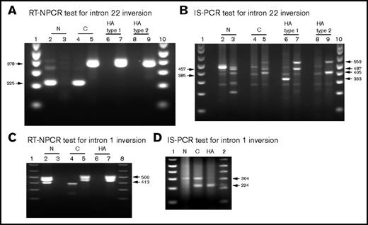 Figure 4. Side-by-side comparison of RT-NPCR (RNA test) and IS-PCR (DNA test) results. See Tables 3 and 4 for an explanation of the bands visualized on these agarose gels. (A) Representative RT-NPCR to detect Inv22 mutations. Lane 1, molecular weight (MW) ladder; lanes 2 and 3, normal control (N) subject; lanes 4 and 5, carrier-Inv22 (C) subject with a type 2 Inv22 mutation; lanes 6 and 7, HA subject with a type 1 Inv22 mutation; lanes 8 and 9, HA subject with a type 2 Inv22 mutation. The 225-bp band is amplified from the N and C samples. The 378-bp band is amplified from the C and HA-Inv22 type 1 or type 2 mutation samples. (B) Representative IS-PCR to detect Inv22 mutations using DNA samples from the same subjects shown in panel A. Lanes 2, 4, 6, and 8 show diagnostic IS-PCR results for the N, C, HA-Inv22-type 1, and HA-Inv22-type 2 samples, respectively. Lanes 3, 5, 7, and 9 show complementary IS-PCR tests for the same samples. Lanes 1 and 10, MW ladder. (C) Representative RT-NPCR to detect Inv1 mutations. Lane 1, MW ladder; lanes 2 and 3, normal control (N) subject; lanes 4 and 5, carrier-Inv1 (C) subject; lanes 6 and 7, HA-Inv1 subject; lane 8, MW ladder. The 413-bp band is amplified from the N and C samples. The 500-bp band is amplified from the C and HA-Inv1 samples. (D) Representative IS-PCR to detect Inv1 mutations using DNA samples from the same subjects shown in panel C. Lanes 1 and 2, MW ladder; lanes N, C, and HA show IS-PCR results for the N, C, and HA-Inv1 subjects.