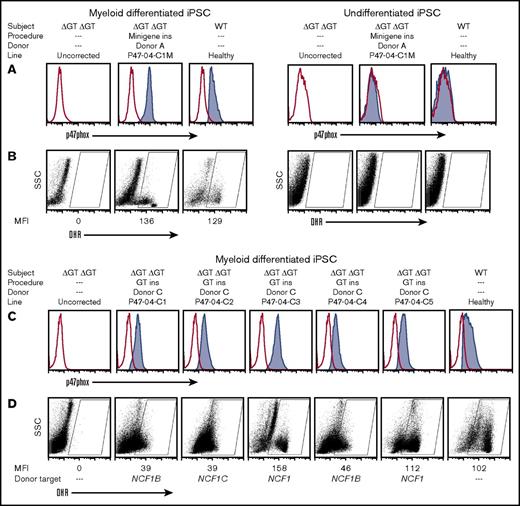 Figure 2. Functional analysis of myeloid cells generated from corrected homozygous exon 2 ΔGT NCF1 p47-CGD iPSCs. The cell treatment procedure is summarized above the graphs, with minigene insertion (ins) mediated by donor A or exon 2 replacement (GT ins) mediated by donor C. (A) Flow cytometric analysis of p47phox expression in myeloid-differentiated iPSC lines, P47-04 (uncorrected) vs minigene-corrected, or healthy control (left 3 panels, respectively) and in undifferentiated iPSCs (right 3 panels). (B) Oxidase function of the uncorrected, minigene-corrected, and healthy control line (left 3 panels, respectively) or the same iPSC lines without differentiation (right 3 panels, respectively) evaluated by dihydrorhodamine (DHR) flow cytometry analysis. (C) Flow cytometric analysis of p47phox expression in myeloid-differentiated iPSC lines, P47-04 (uncorrected) vs five exon 2–corrected, and healthy control, respectively. (D) Oxidase function of the uncorrected, 5 exon 2–corrected, and healthy control lines, respectively, or the same iPSC lines without differentiation, respectively, was evaluated by DHR. Also indicated below these graphs (Donor target) is where the correction occurred (NCF1 gene or the NCF1B or NCF1C pseudogene) as determined by sequence analysis (Figure 5). rAAV2 vector was used between 200 and 400 MOI of viruses per cell. SSC, side scatter; WT, wild-type.