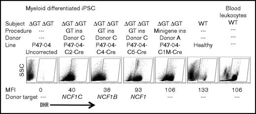 Figure 3. Oxidase activity following Cre excision. Analysis of DHR oxidase activity in myeloid differentiated iPSC lines following Cre-mediated recombination excision of the puromycin cassette. Shown are analyses of corrected iPSC lines (P47-04C2,4,5-Cre GT exon 2 corrected; P47-04-C1M-Cre minigene corrected) compared with uncorrected (P47-04), healthy control iPSCs, or healthy control peripheral blood. The DHR assay, gating for MFI assessment, and donor target assessment are as described in the Figure 2D legend.