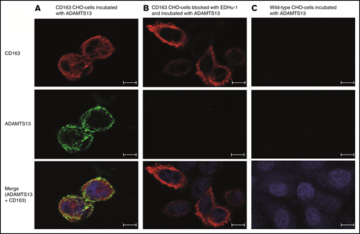 CD163 transfected CHO cells internalize ADAMTS13. Binding and uptake of Alexa Fluor 488–labeled ADAMTS13 by CD163-expressing and control CHO cells. (A) CD163-transfected CHO cells internalize ADAMTS13-AF488. (B) ADAMTS13 binding and uptake was reduced by the addition of blocking antibody EDHu-1. (C) Untransfected CHO cells stained for CD163 do not internalize ADAMTS13-AF488. Upper panels show staining for CD163–Alexa Fluor 633 (in red). Middle panels correspond to the signal obtained following internalization of ADAMTS13-AF488 (in green). The overlay of CD163 staining (red) and internalized ADAMTS13-AF488 (green) is displayed in the lower panels. ProLong Gold DAPI (blue signal) was used to stain nuclei. Scale bars are 10 μm.