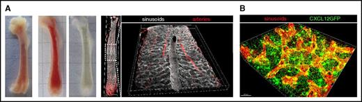 Figure 1. Three-dimensional imaging of BM. (A) Representative stages of murine femoral bones during processing for 3D imaging as described in Nombela-Arrieta et al.13 From left to right: unsectioned, sliced unprocessed, and optically cleared BM slices. The last 2 images to the right correspond to an example of 3D reconstruction of the entire BM microvascular system of the femur (arteries and sinusoids) using multidimensional confocal imaging of a cleared BM slice. A detailed view of the central sinus running along the longitudinal axis of the marrow is provided. (B) High-resolution 3D imaging of a reduced field of view showing sinusoidal vessels (red) and the network of perivascular bodies of CAR cells (green), forming a dense matrix through the emission of abundant cytoplasmic projections.