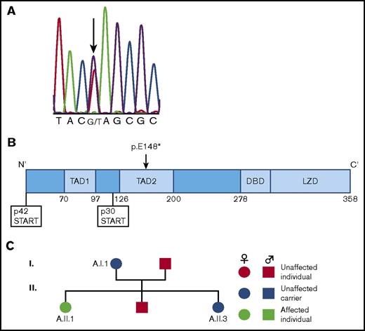 Figure 1. Discovery of a family with a novel CEBPA germ line mutation. (A) Sequencing chromatogram demonstrating the germ line CEBPA mutation (c.442G>T) present in our patient. Sanger sequencing was performed on genomic DNA isolated from cultured skin fibroblasts taken from our patient while she was in CR. (B) Location of the germ line CEBPA mutation (p.E148*) discovered here relative to the p30 start codon. This mutation is unusual relative to the majority of previously discovered germ line CEBPA mutations in that it is downstream of the p30 start codon. (C) Pedigree of family members showing affected patient (A.II.1) and unaffected carriers (A.I.1, A.II.3).