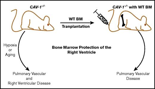 Figure 4. BM in the pathogenesis of PH and RV disease. CAV-1–deficient BM from CAV−/− mice with hypoxia induces pulmonary vascular remodeling and RV hypertrophy. WT BM can protect CAV−/− mice from RV disease that occurs with aging, but not PV disease. Disease-producing BM is skewed to megakaryocyte/erythroid lineage differentiation.
