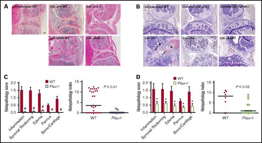 Figure 2. Elimination of uPA or uPAR in DBA/1 mice results in diminished CIA knee joint pathology. (A) Representative hematoxylin and eosin–stained knee joint sections from unchallenged WT and CIA-challenged WT, uPA−/−, uPAR WT, and uPAR−/− cohorts. Upon CIA challenge, significant inflammation, synovial hyperplasia, and erosive pannus are apparent in WT mice, whereas knee joints of uPA−/− and uPAR−/− mice display markedly attenuated pathological features. Scale bar represents 200 μm. (B) Representative knee joint sections of unchallenged and CIA-challenged WT, uPA−/−, and uPAR−/− mice stained by immunohistochemistry for fibrin. Note the fibrin staining along articular surfaces (arrows) and within hyperplastic synovial tissue (asterisk) as CIA-challenged WT mice. Scale bar represents 200 μm. (C) Semiquantitative microscopic analysis of knee joint pathological features from WT (n = 29, red bars) and Plau−/− (n = 17, white, blue outline bars) mice. Student t test. Scatter plot of composite histopathology index analysis (see Materials and methods) of hematoxylin and eosin–stained knee joint sections. (D) Semiquantitative microscopic analysis of knee joint pathological features from WT (n = 8, red bars) and Plaur−/− (n = 16, white, green outline bars) mice. Student t test. Scatter plot of composite histopathology index analysis (see Materials and methods) of hematoxylin and eosin–stained knee joint sections. Each symbol represents the composite score for individual knees and bars denote median values for each genotype. P values were determined by Mann-Whitney U test. #P < .001 and *P < .05.