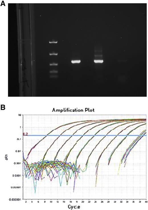 Low-cost polymerase chain reaction assays for JAK2-V617F and BCR-ABL mutations were optimized, validated, and made available at RMI, Peshawar. Two technicians were further trained on polymerase chain reaction procedures and competence-based training manuals were designed.