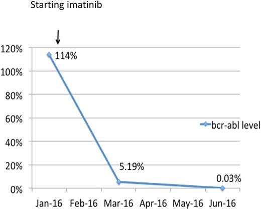 Figure 1. BCR-ABL % response to imatinib therapy.