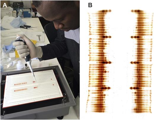 Figure 2. (A) IEF gel preparation at BMC. (B) Completed gel that was scanned and e-mailed to collaborators.