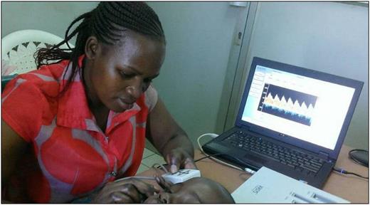 Figure 2. A study technician conducting a transcranial Doppler scan on a child with SCA.