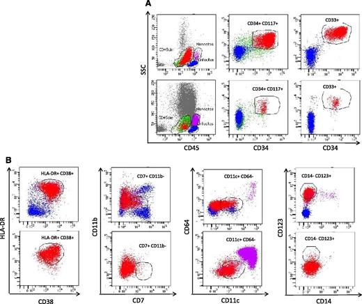 Figure 2. Representative MPFC analysis of AML at diagnosis (upper panels) and MRD1 (lower panels). After sample preparation, cells are labeled with the antibody mixture to identify the backbone leukemic blasts (CD45, CD34, CD117 and CD33, panel A) followed by combinations of fluorochrome-conjugated monoclonal antibodies directed to the leukemic phenotypes (CD38, HLA-DR, CD11b, CD7, CD4, CD56, CD13, CD19, CD11c, CD64, CD133, CD15, NG2, and CD41 (examples in B) at room temperature in the dark. Blast cells are identified by using the gating templates defined at diagnosis. The staining tubes that define the LAIPs at diagnosis are then repeated at the MRD points of study.